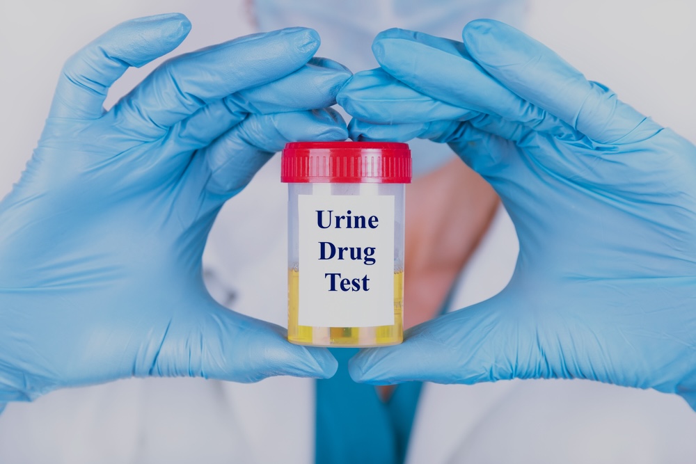 Urine sample in a plastic container from a meth drug test