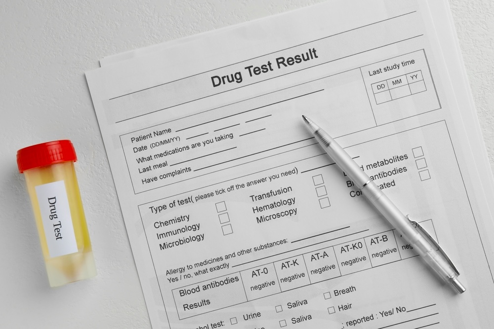 Forms indicating cocaine drug test results