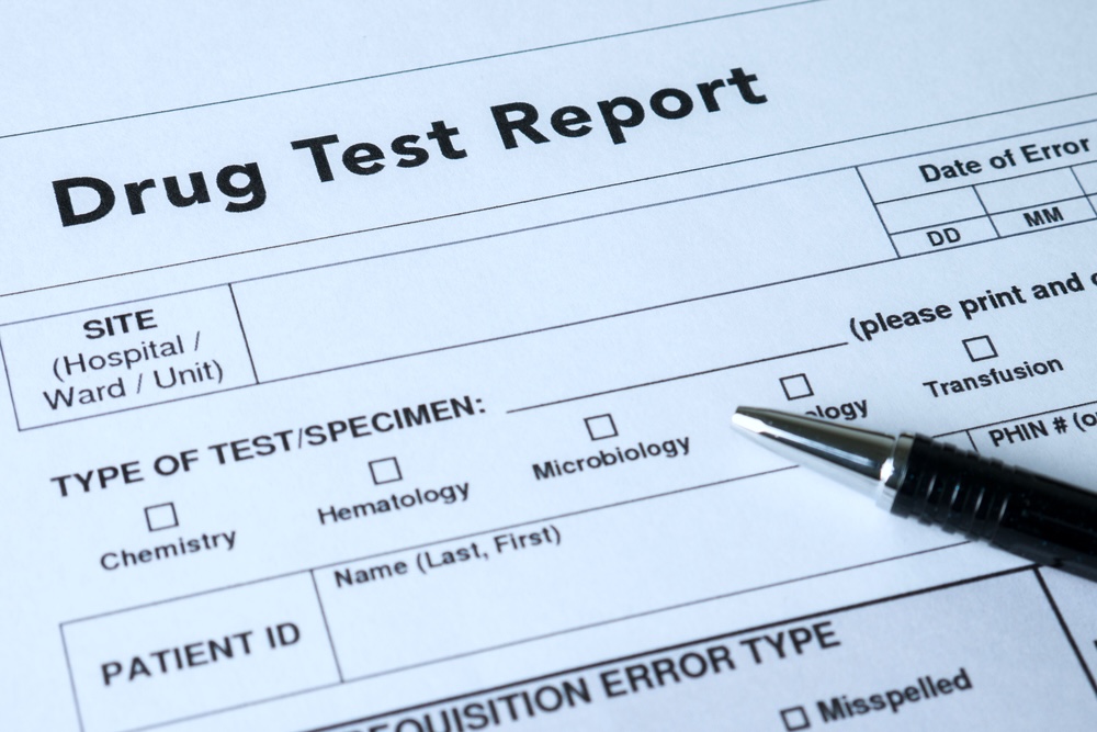 Drug test report for benzos